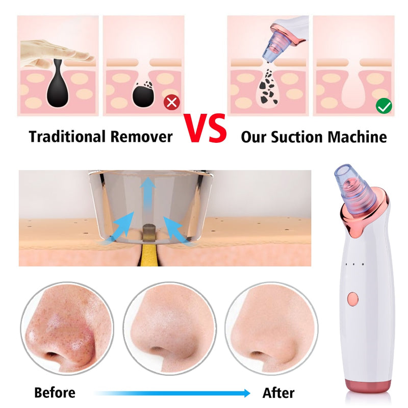 Blackhead Instrument Electric Suction Facial